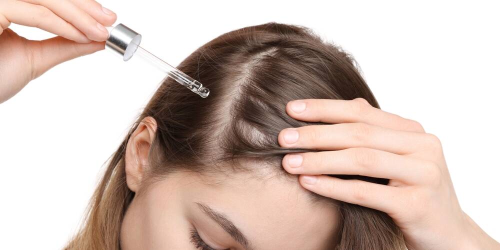 hair,loss,problem.,girl,applying,serum,onto,hairline,on,white